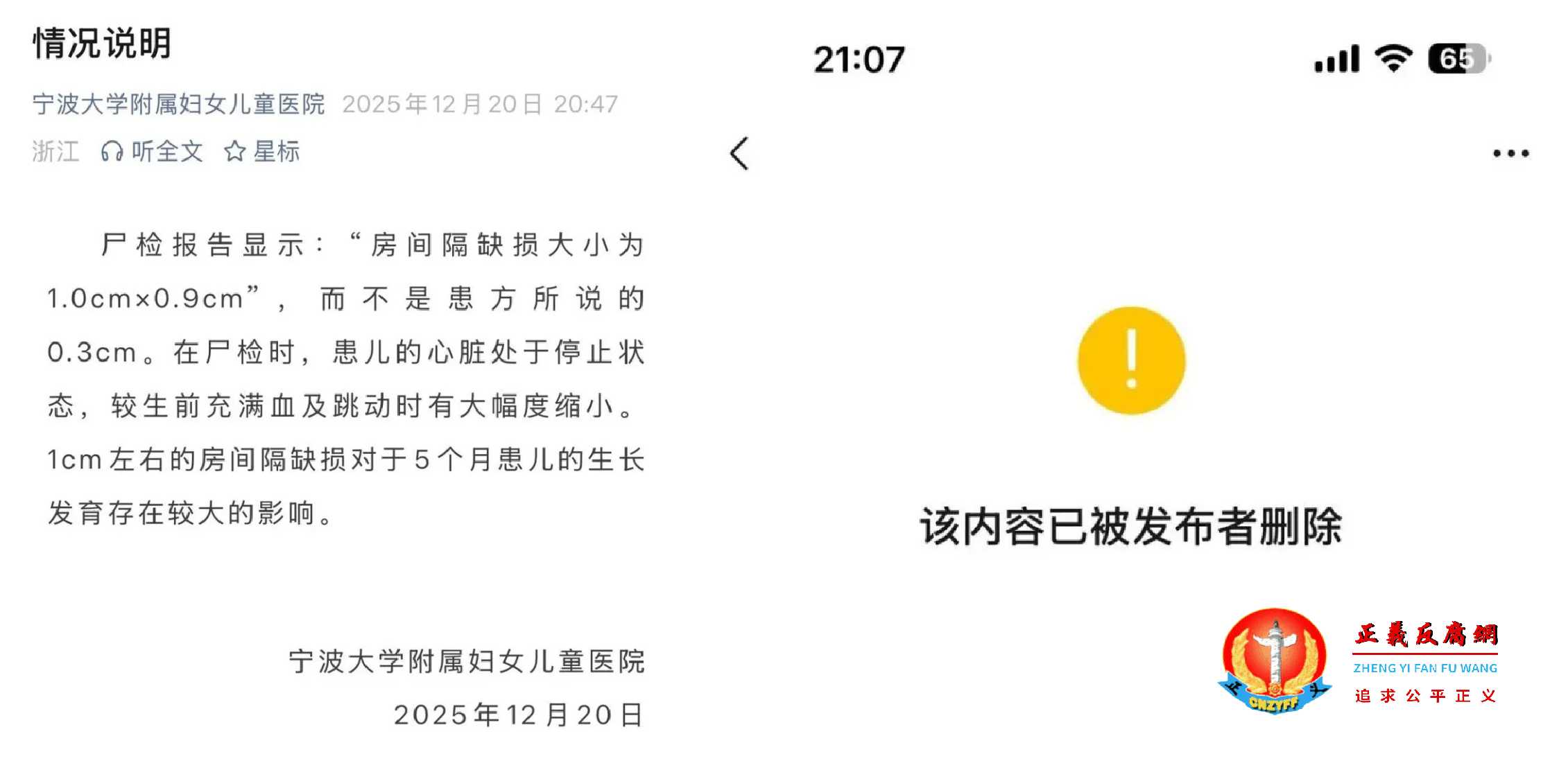 关于患儿尸检报告，宁波大学附属妇女儿童医院发布情况说明后又删了.jpg